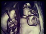 „Instagram“ nuotr./Danios Ramirez echoskopija