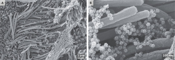 Photo by C. Ehre / Black and white photos of SARS-CoV-2: more contrast for scientists